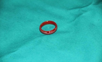 Oyun oynarken yerdeki yüzüğü yutan 3 yaşındaki çocuk ölümden döndü